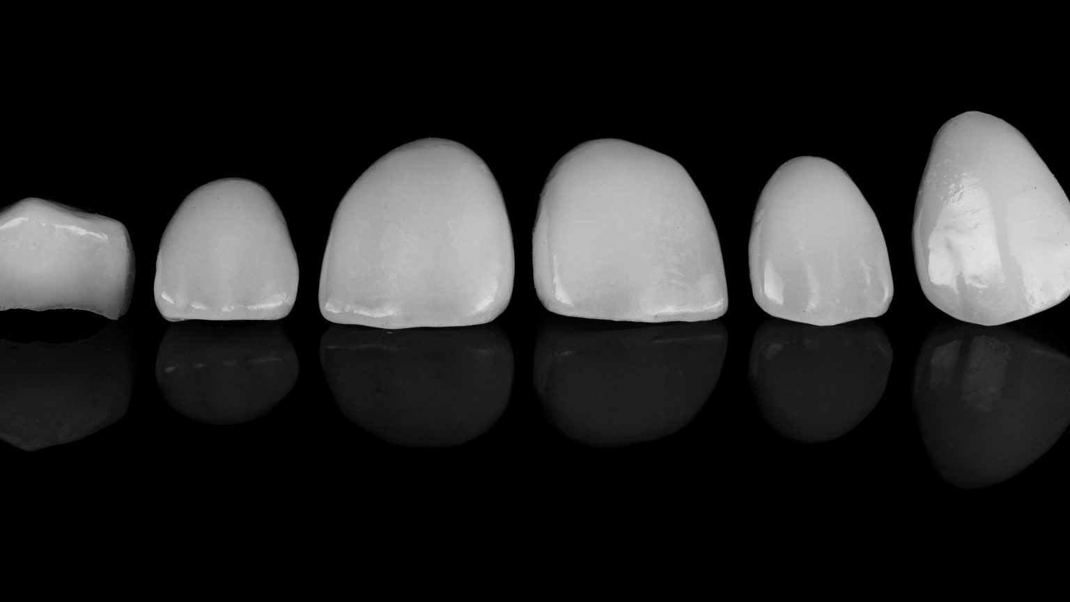 Curso de Facetas